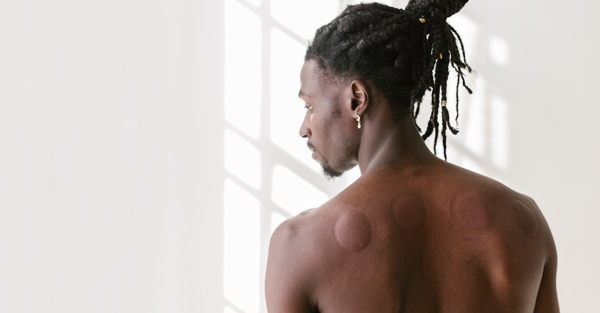 découvrez le cupping, une technique de thérapie alternative aux multiples bienfaits. apprenez comment cette pratique ancestrale stimule la circulation sanguine, soulage les douleurs musculaires et favorise la détente. explorez les différents types de cupping et trouvez la méthode qui vous convient le mieux.